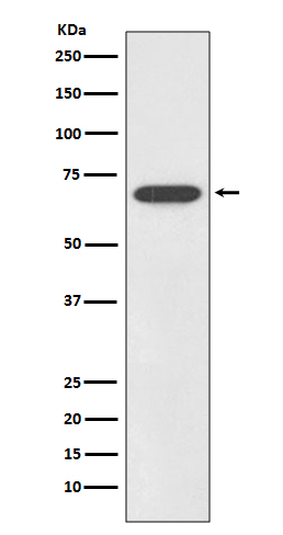 SOX11 Rabbit mAb