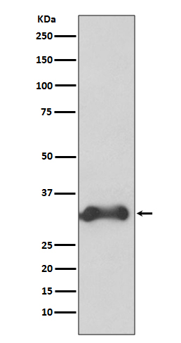 Cyclin D3 Rabbit mAb