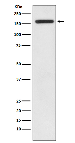 IRS1 Rabbit mAb