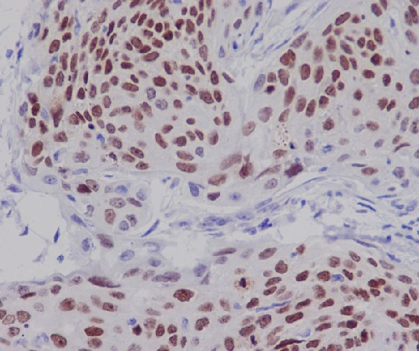 CDK9 Rabbit mAb