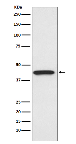 CDK9 Rabbit mAb