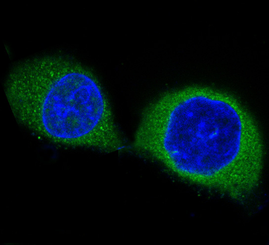 PDPK1 Rabbit mAb