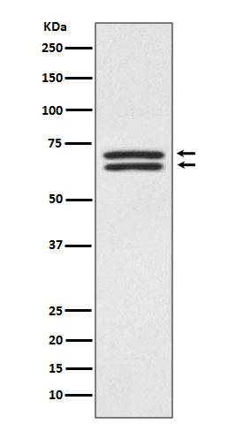 PDPK1 Rabbit mAb