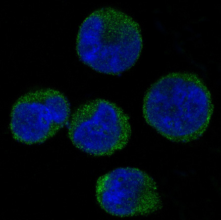 CDK6 Rabbit mAb