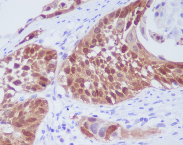 CDK6 Rabbit mAb