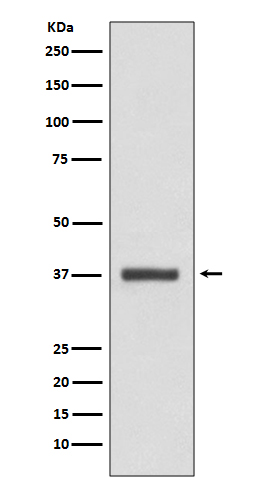 CDK6 Rabbit mAb