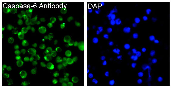 Caspase-6 Rabbit mAb