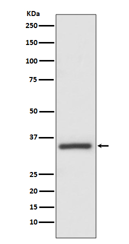 Caspase-6 Rabbit mAb