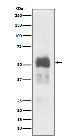 Tau Rabbit mAb