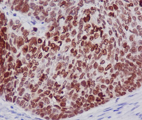 Histone H2B Rabbit mAb