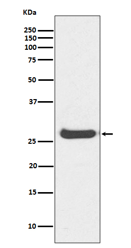 Histone H1.0 Rabbit mAb