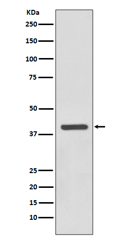 SIRT6 Rabbit mAb