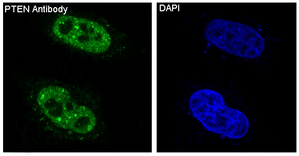 PTEN Rabbit mAb