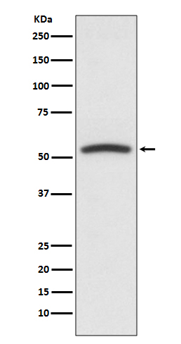 PTEN Rabbit mAb