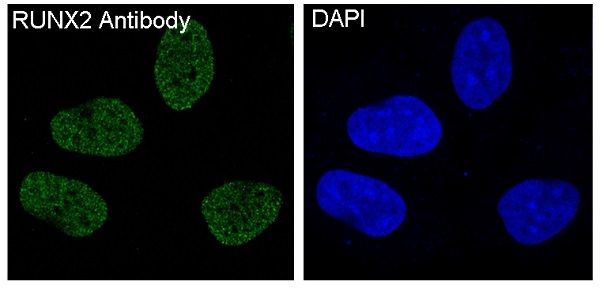 RUNX2 Rabbit mAb