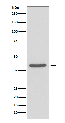 SIRT2 Rabbit mAb