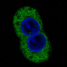 STAT2 Rabbit mAb