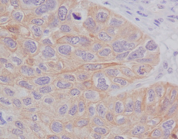 STAT2 Rabbit mAb