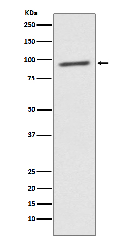 STAT2 Rabbit mAb