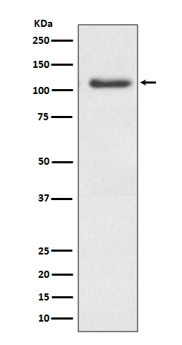 ERK5 Rabbit mAb