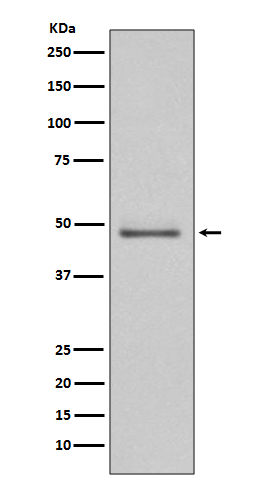 MEK5 Rabbit mAb