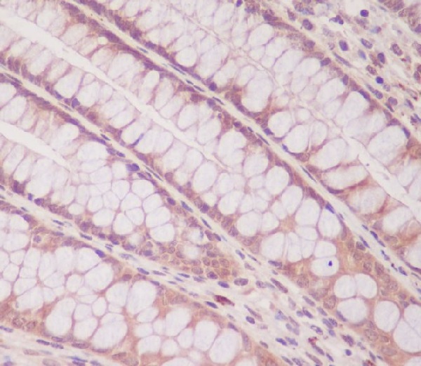 Smad1 Rabbit mAb