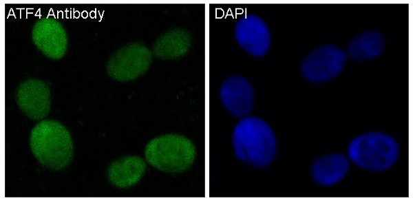 ATF4 Rabbit mAb