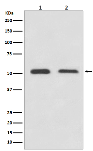 ATF4 Rabbit mAb