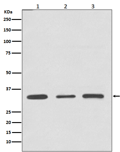 ATF5 Rabbit mAb