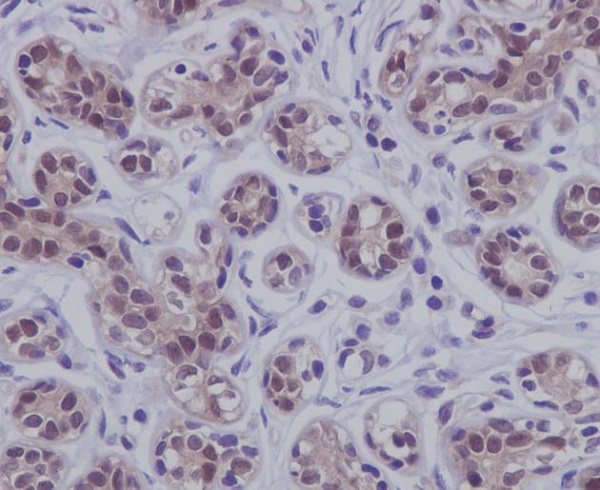 STAT5b Rabbit mAb