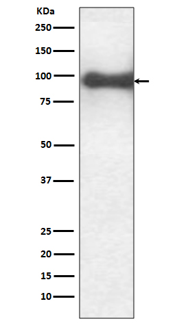 TrkB Rabbit mAb