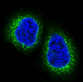 HDAC10 Rabbit mAb