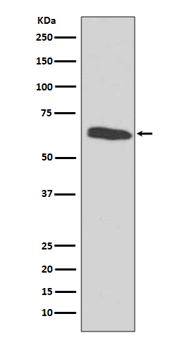 HDAC2 Rabbit mAb