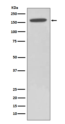 HDAC6 Rabbit mAb