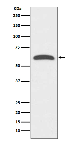 FoxO4 Rabbit mAb