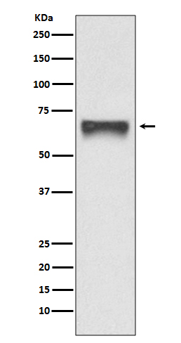 FoxO4 Rabbit mAb