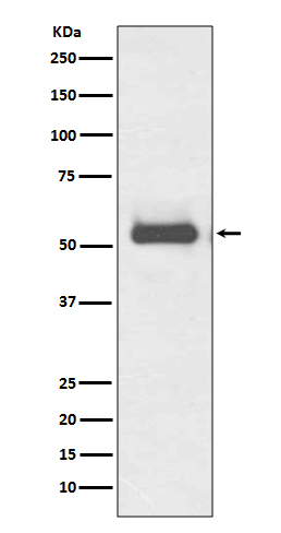 TRK fused gene Rabbit mAb