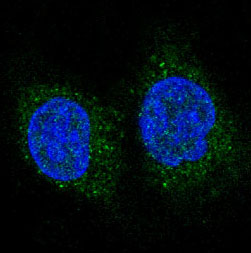 FoxO3a Rabbit mAb