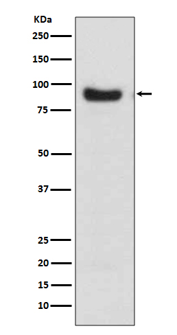 FoxO3a Rabbit mAb