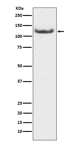 HDAC7 Rabbit mAb