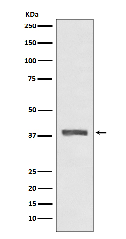 AMPK beta 1 Rabbit mAb