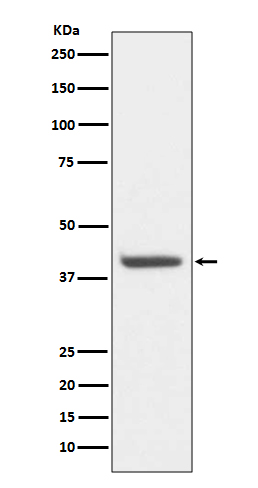 HDAC8 Rabbit mAb