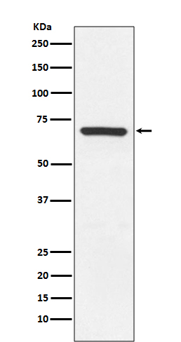 MEKK3 Rabbit mAb