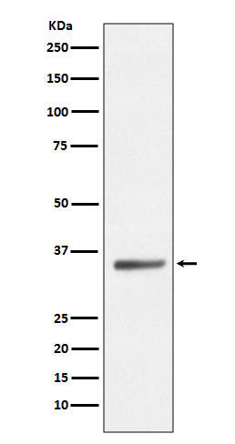 SIRT5 Rabbit mAb