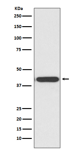 HDAC8  Rabbit mAb