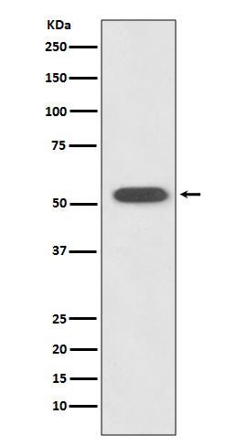 HSPA14 Rabbit mAb