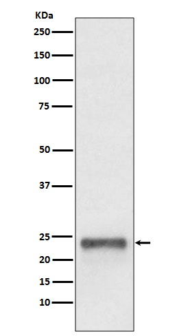 Ubiquitin D Rabbit mAb