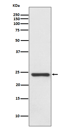 HSPB8/HSP22 Rabbit mAb