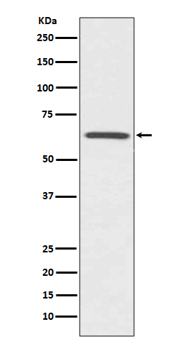 CDC42EP1 Rabbit mAb