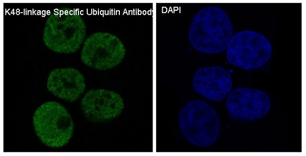 K48-linkage Specific Ubiquitin Rabbit mAb